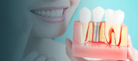 Удаление имплантата зуба